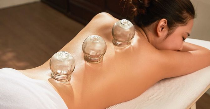 Cupping Therapy