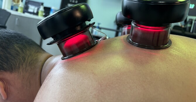 Dynamic Cupping Therapy